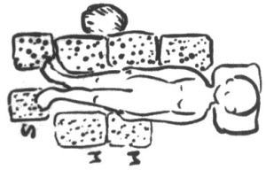 仰臥位の基本姿勢（側面から見た図）